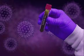LIISPV engega una campanya de donacions per la lluita contra el coronavirus SARS-CoV-2